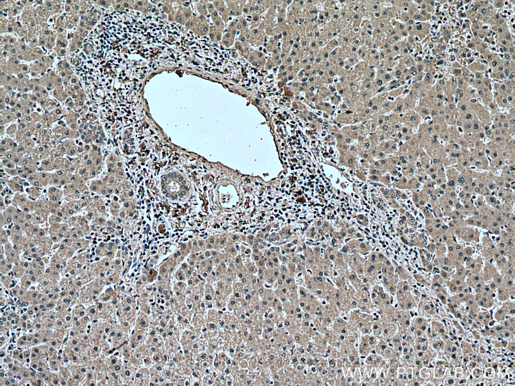 IHC staining of human liver using 67308-1-Ig