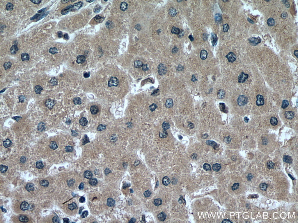 IHC staining of human liver using 67308-1-Ig