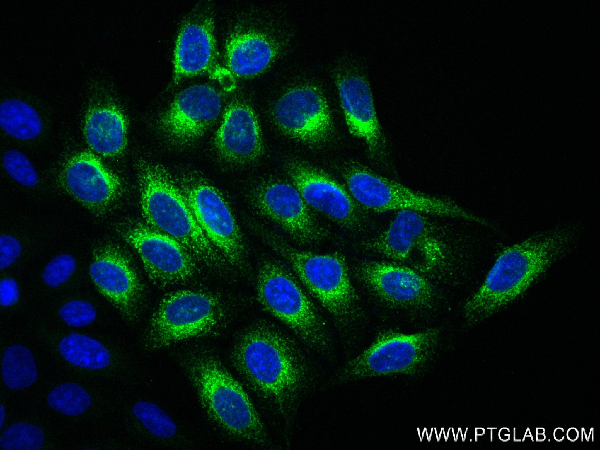 IF Staining of HepG2 using 84347-5-RR