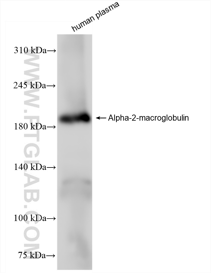 WB analysis of human plasma using 84347-5-RR