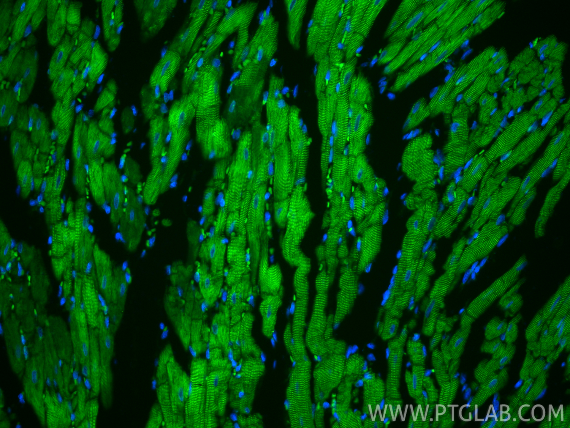 IF Staining of rat heart using CL488-86340-2 IF Staining of rat heart using CL488-86340-2