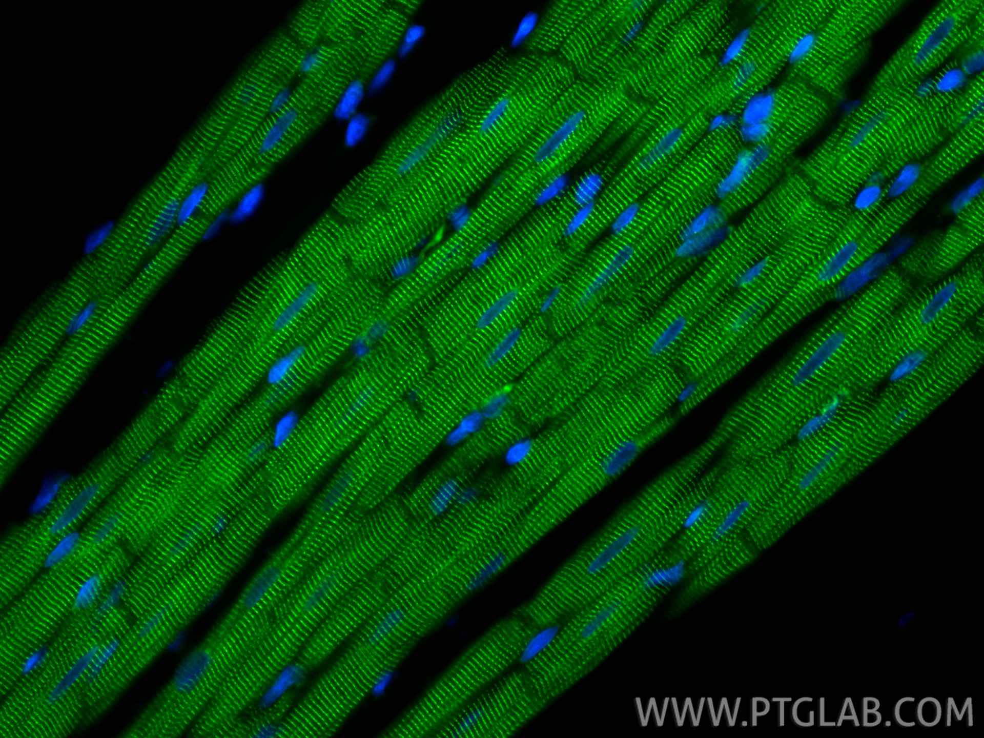IF Staining of rat heart using CL488-86340-2 IF Staining of rat heart using CL488-86340-2