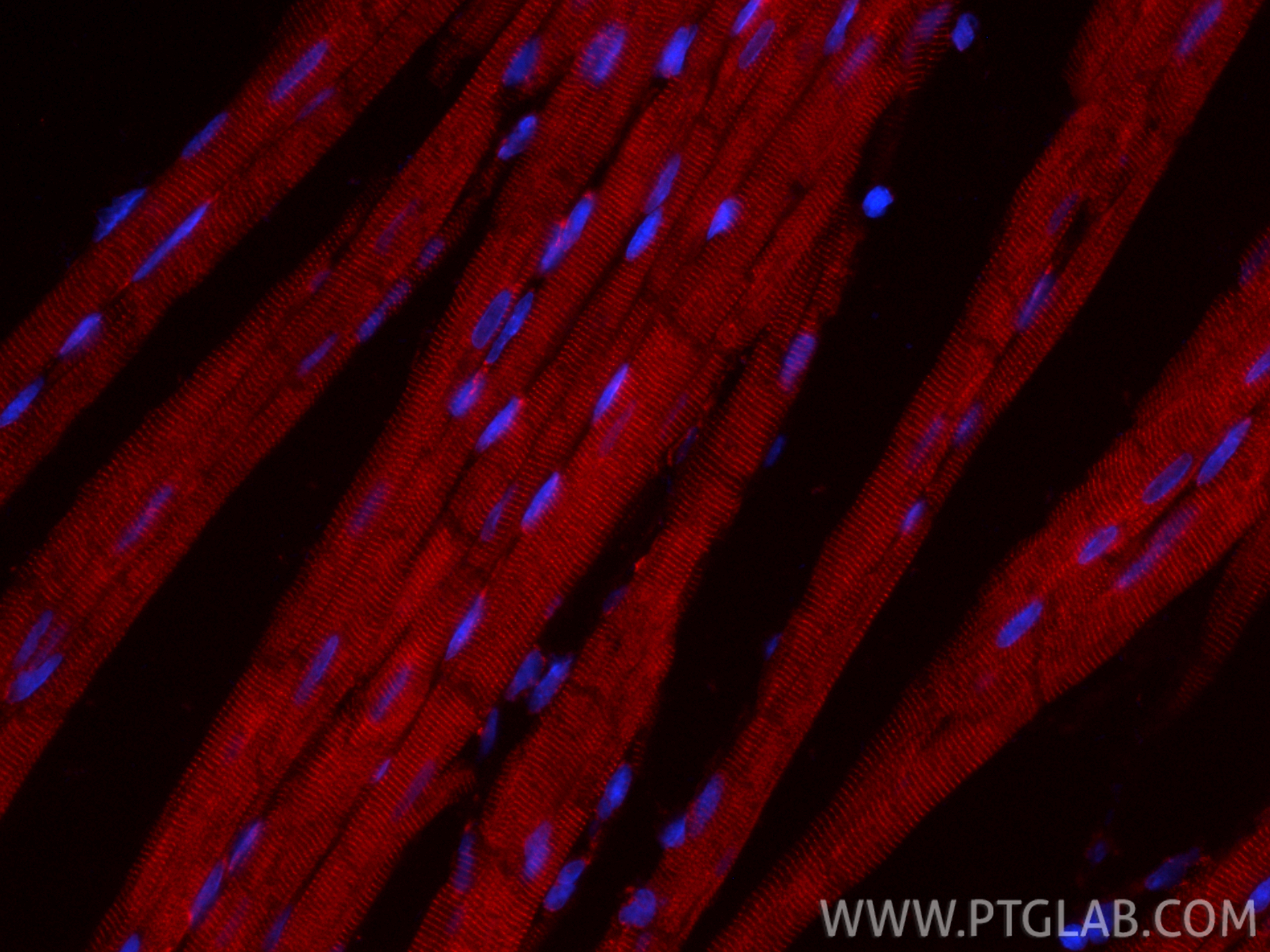 IF Staining of rat heart using CL594-86340-2 IF Staining of rat heart using CL594-86340-2