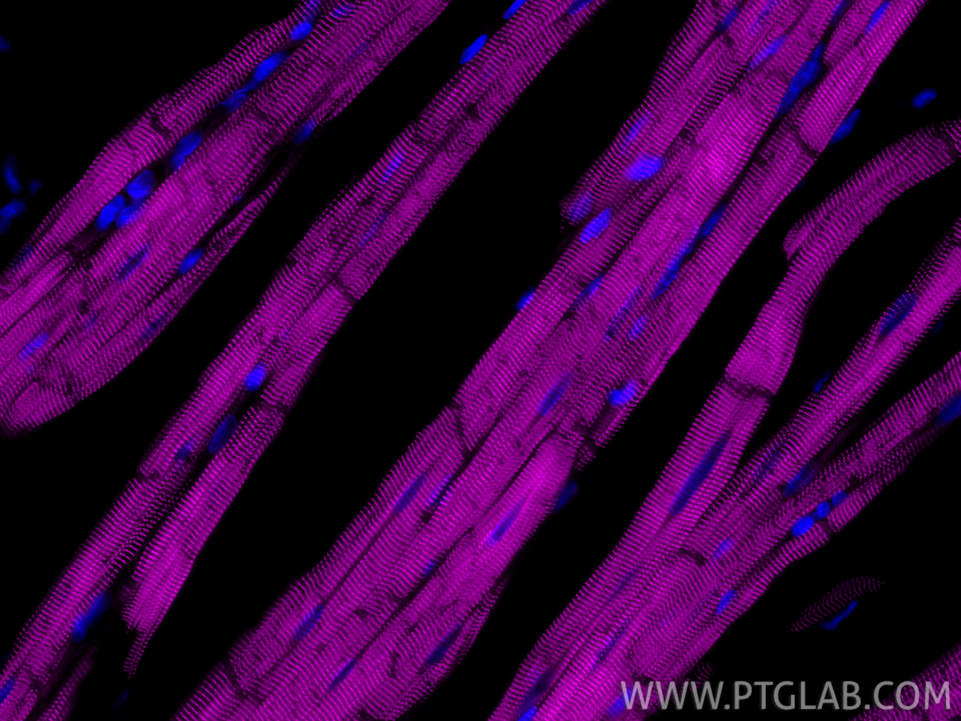IF Staining of rat heart using CL647-86340-2 IF Staining of rat heart using CL647-86340-2