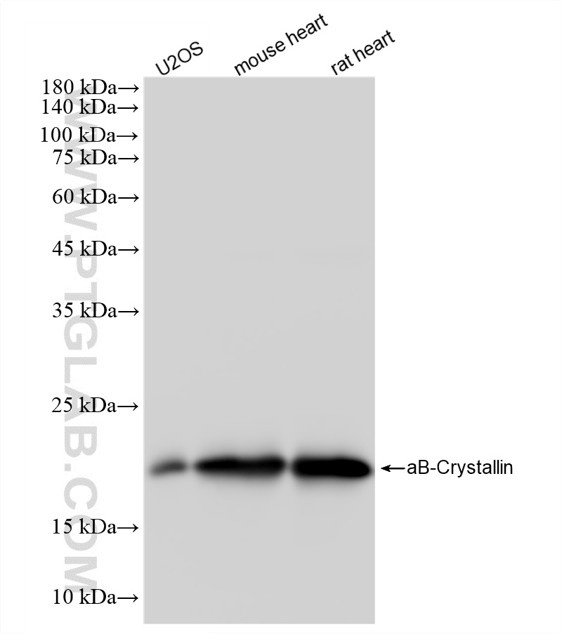 WB analysis using 87851-1-RR (same clone as 87851-1-PBS) WB analysis using 87851-1-RR (same clone as 87851-1-PBS)