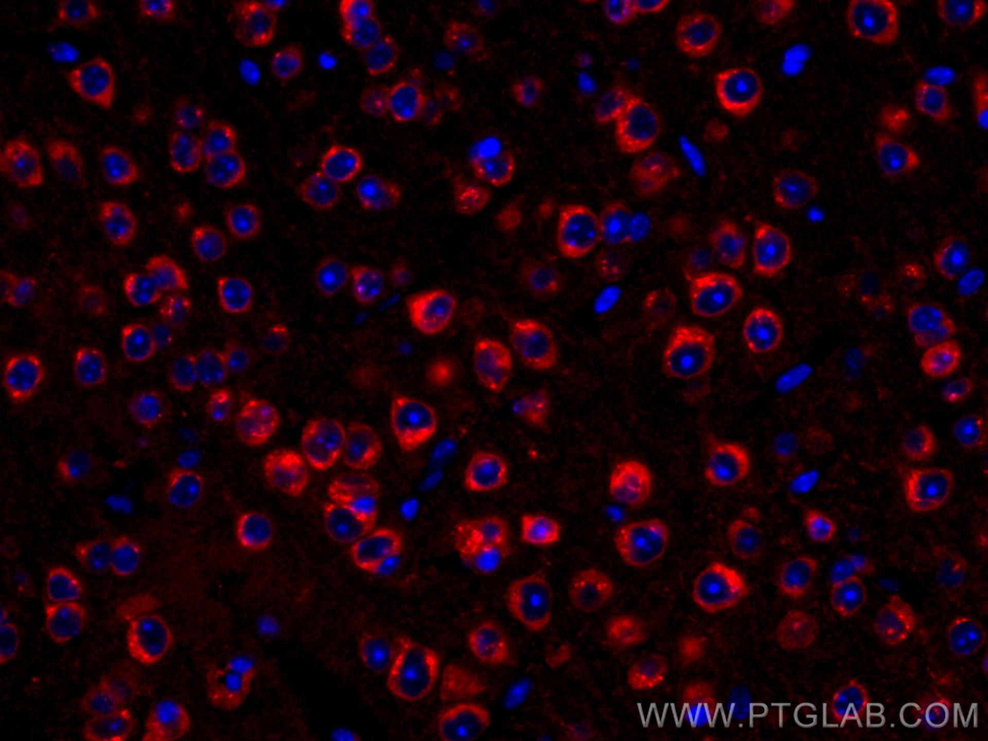 IF Staining of mouse brain using CL594-67323