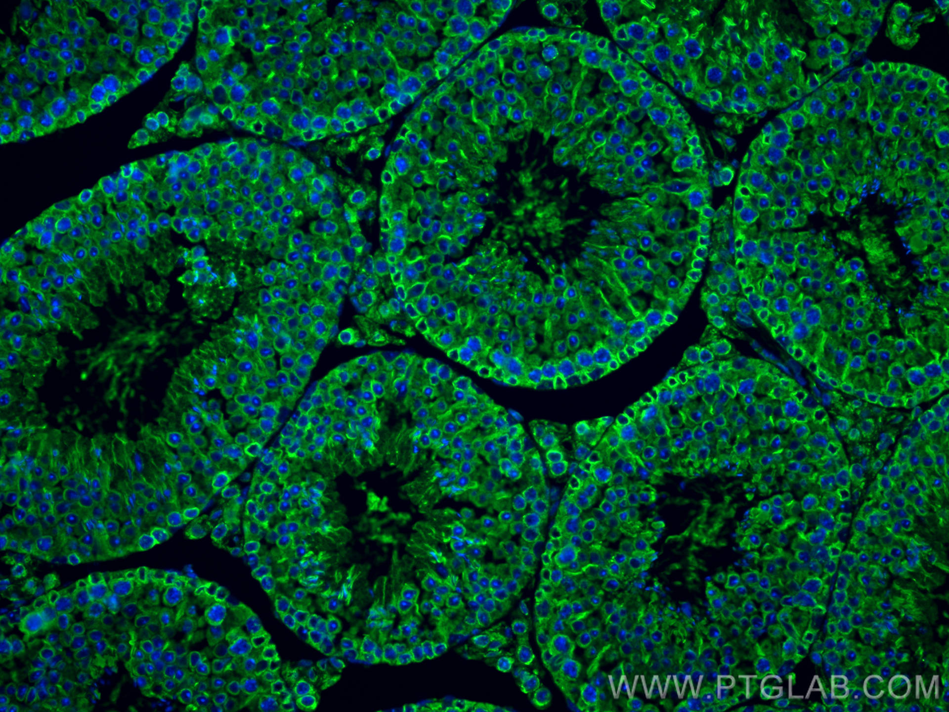 IF Staining of mouse testis using 80762-1-RR