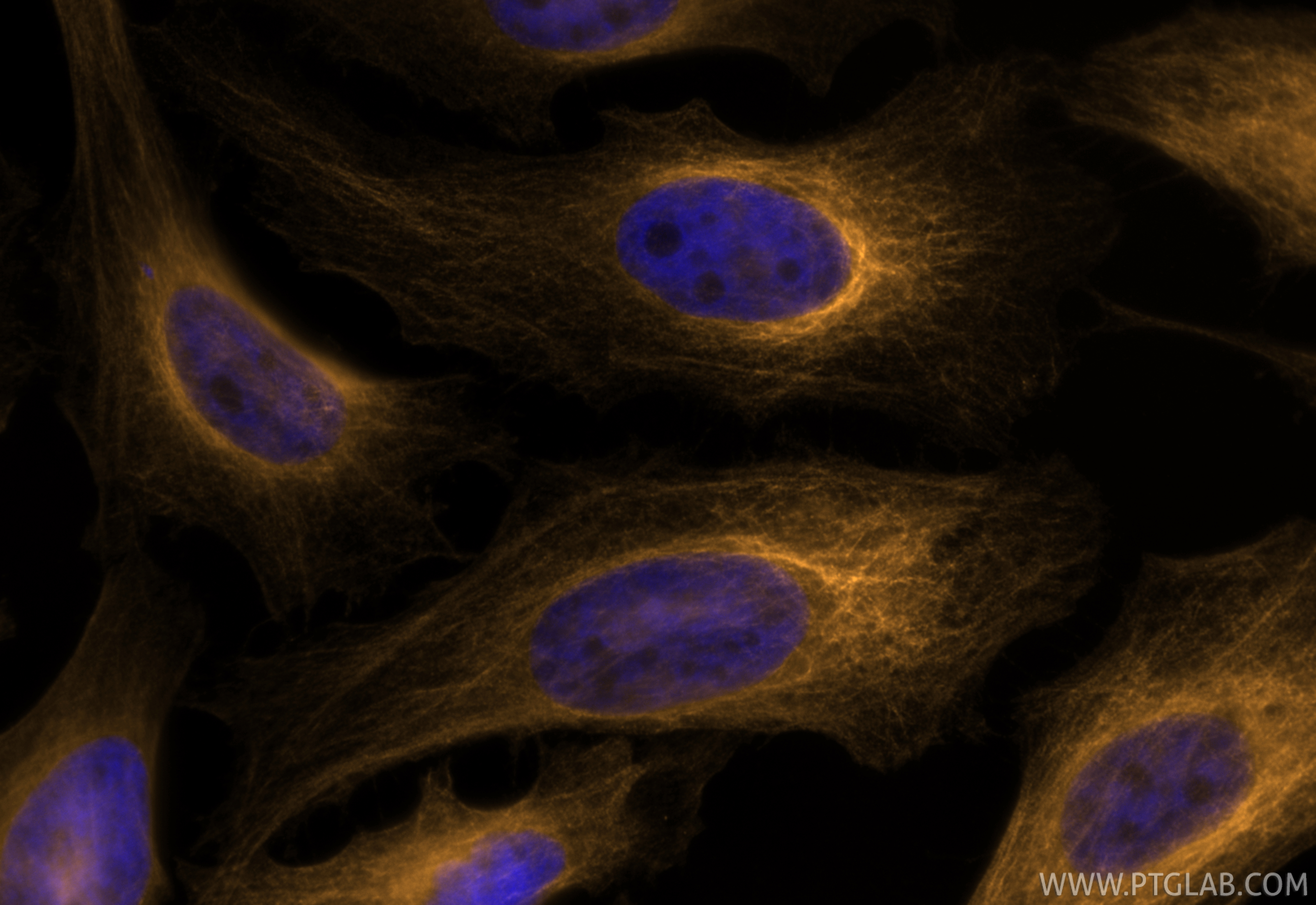 IF Staining of HeLa using CL555-80762