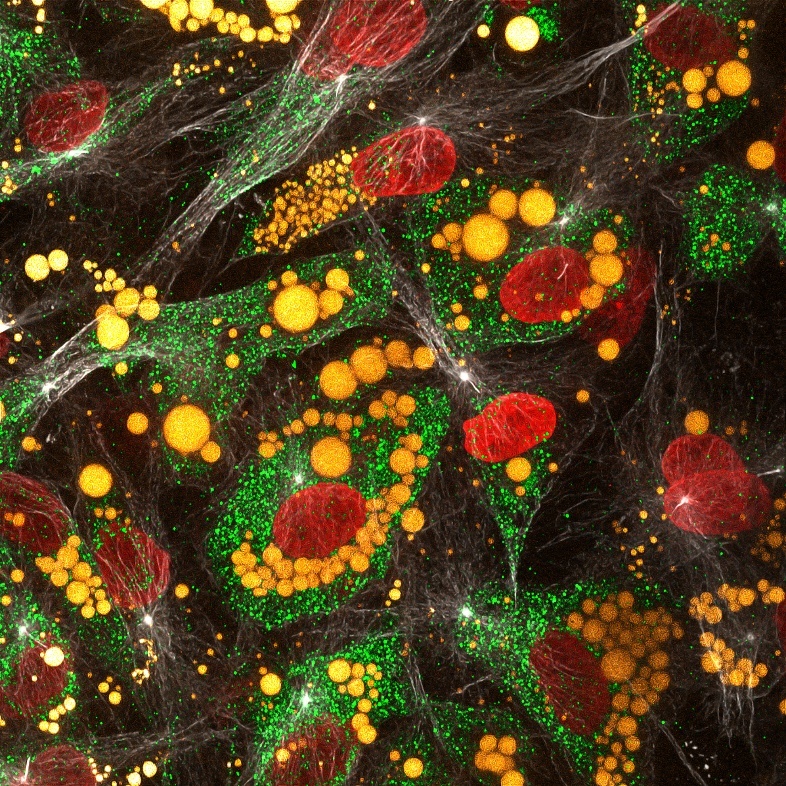 IF Staining of human adipose-derived mesenchymal stem cells using CL594-80762