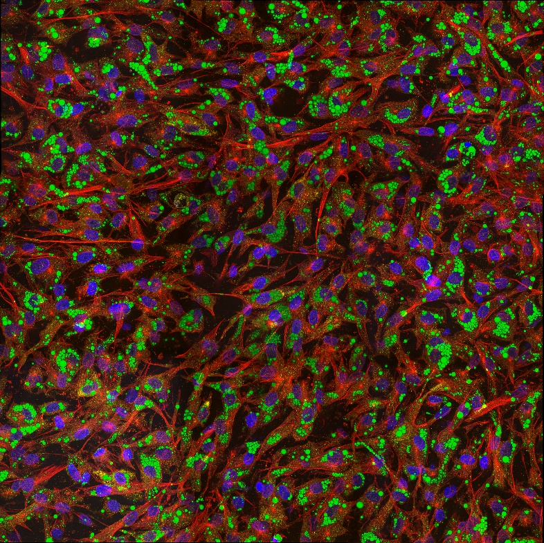 IF Staining of human adipose-derived mesenchymal stem cells using CL594-80762