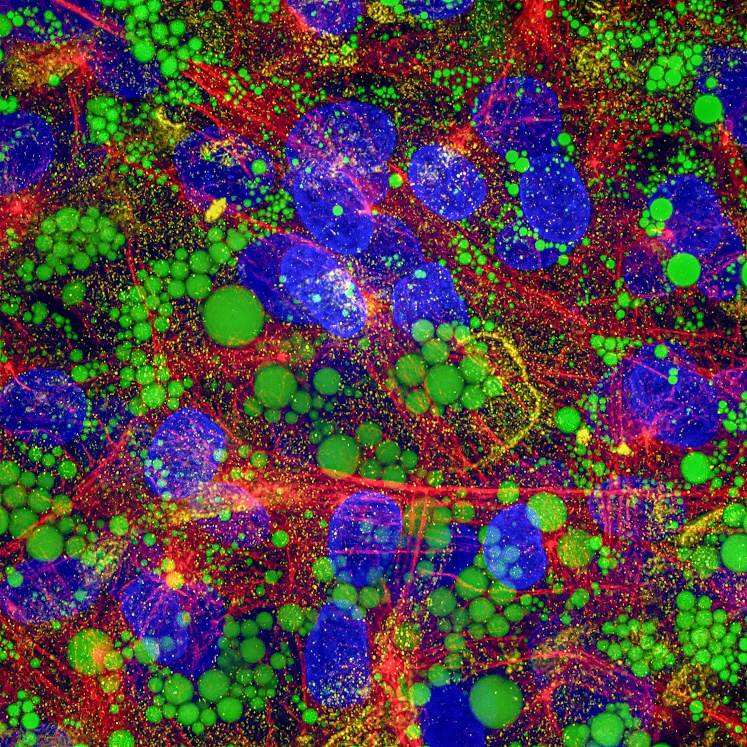IF Staining of human adipose-derived mesenchymal stem cells using CL594-80762