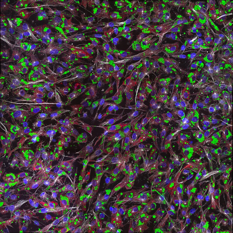 IF Staining of human adipose-derived mesenchymal stem cells using CL594-80762