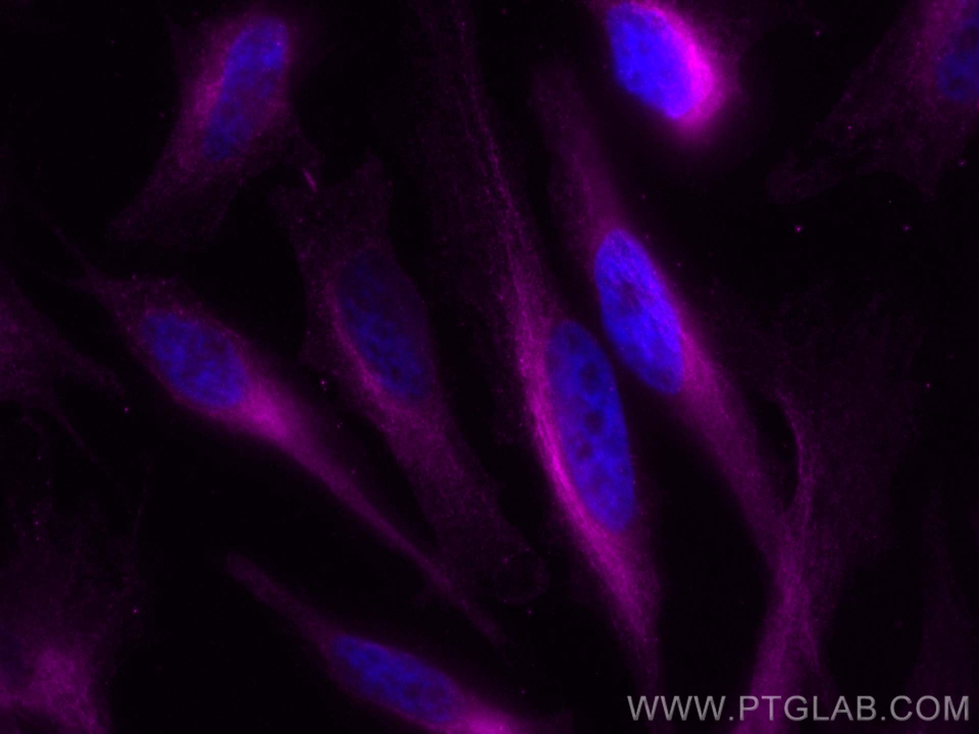 IF Staining of HeLa using CL647-66031