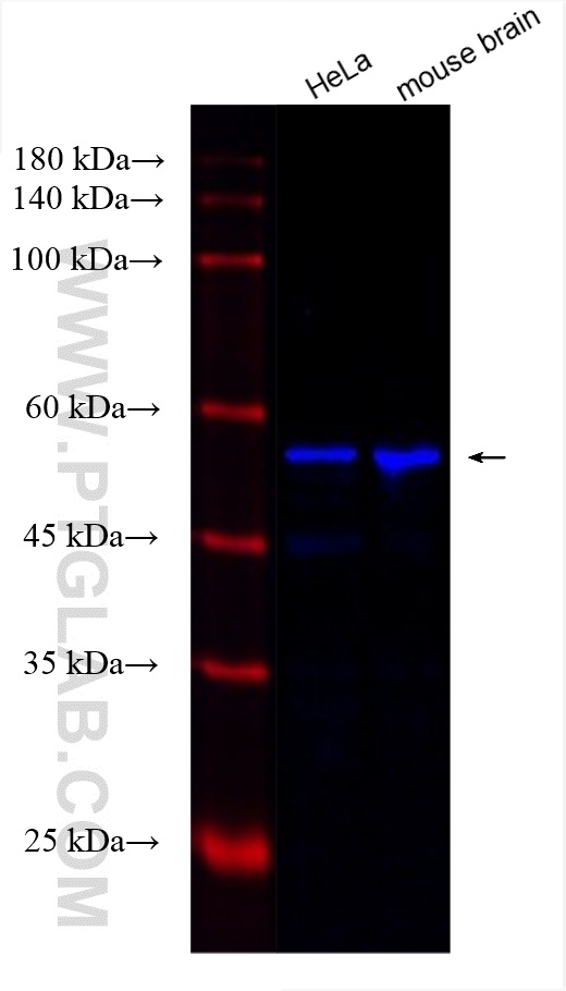 Alpha Tubulin