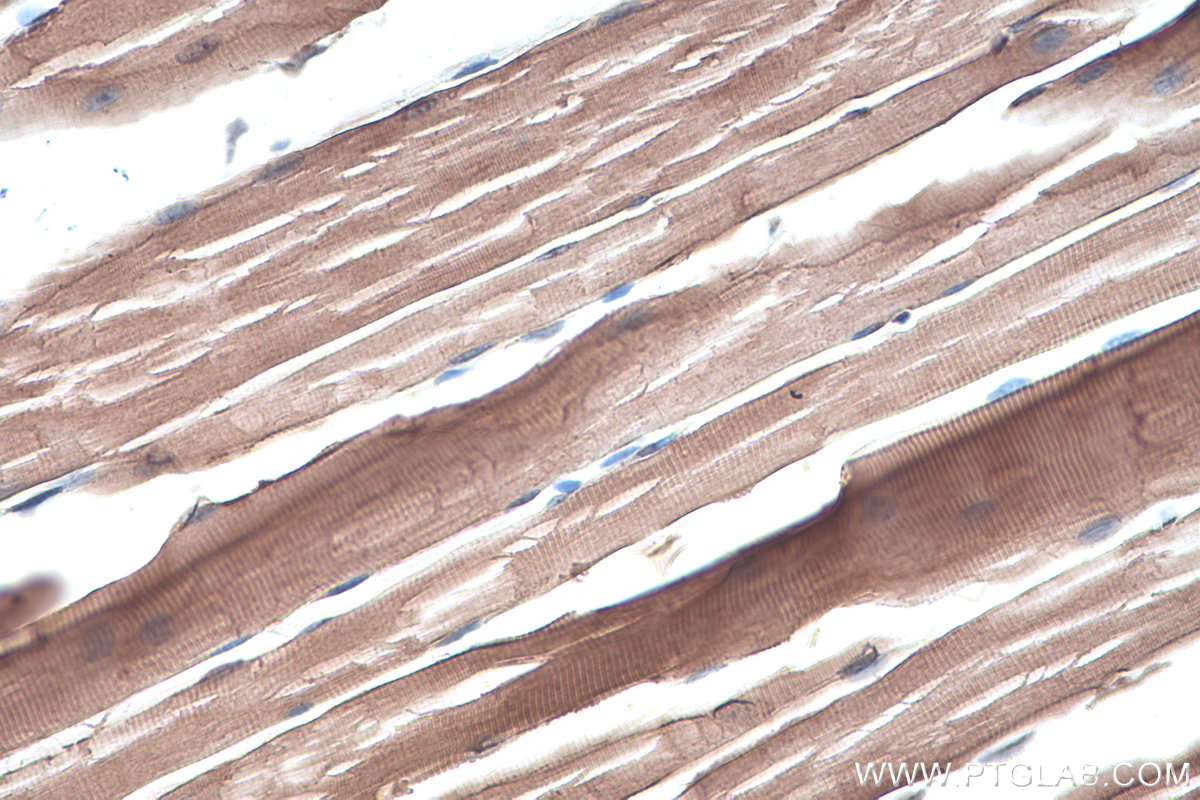 IHC staining of mouse skeletal muscle using 67078-1-Ig