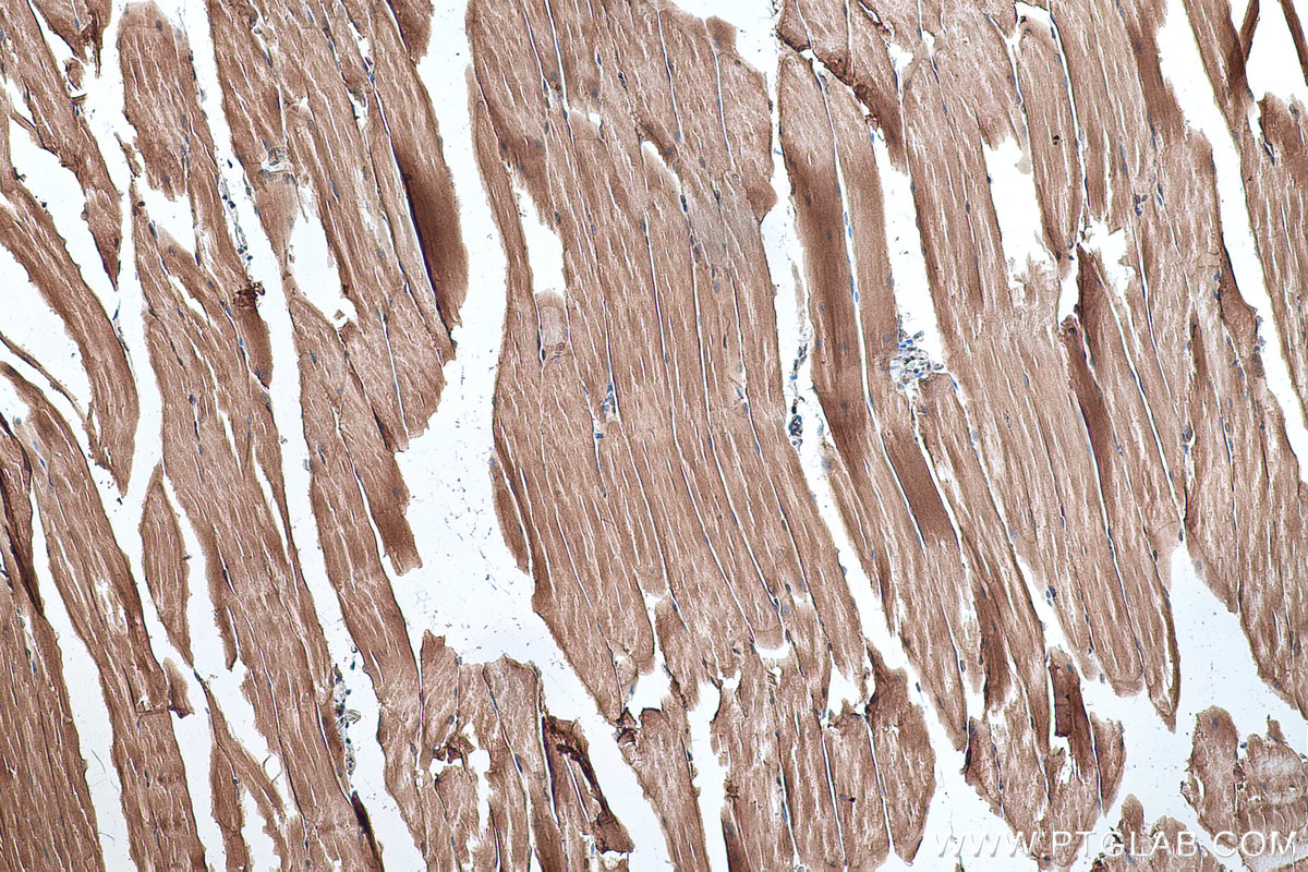 IHC staining of mouse skeletal muscle using 67078-1-Ig