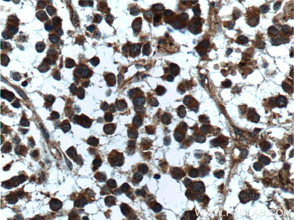 APP/Beta Amyloid Polyclonal antibody