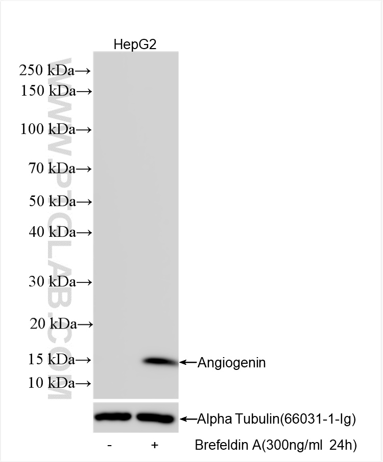 WB analysis using 85635-1-RR (same clone as 85635-1-PBS)