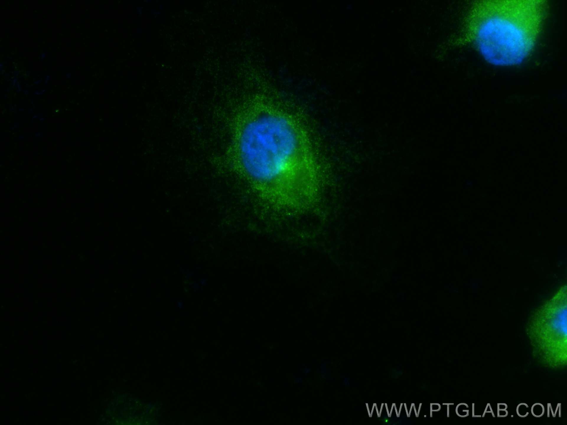 IF Staining of HUVEC using 27093-1-AP