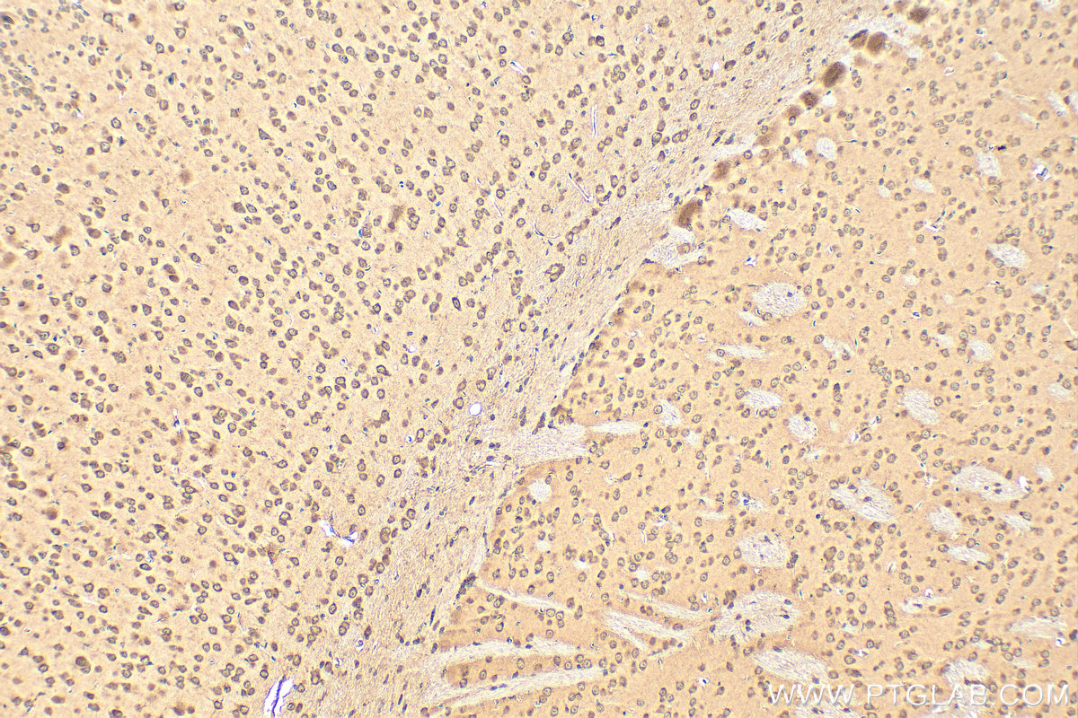 IHC staining of mouse brain using 31499-1-AP IHC staining of mouse brain using 31499-1-AP