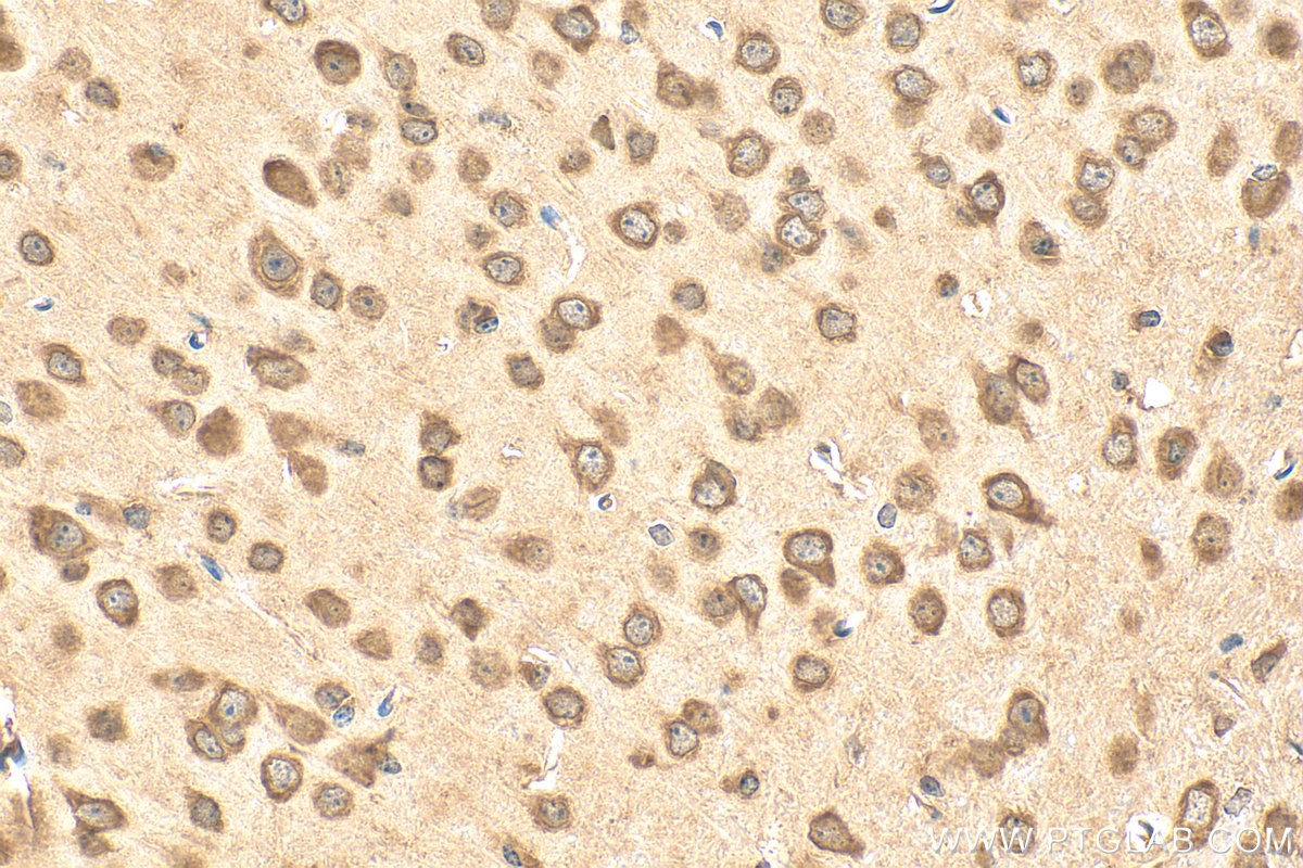 IHC staining of mouse brain using 31499-1-AP IHC staining of mouse brain using 31499-1-AP