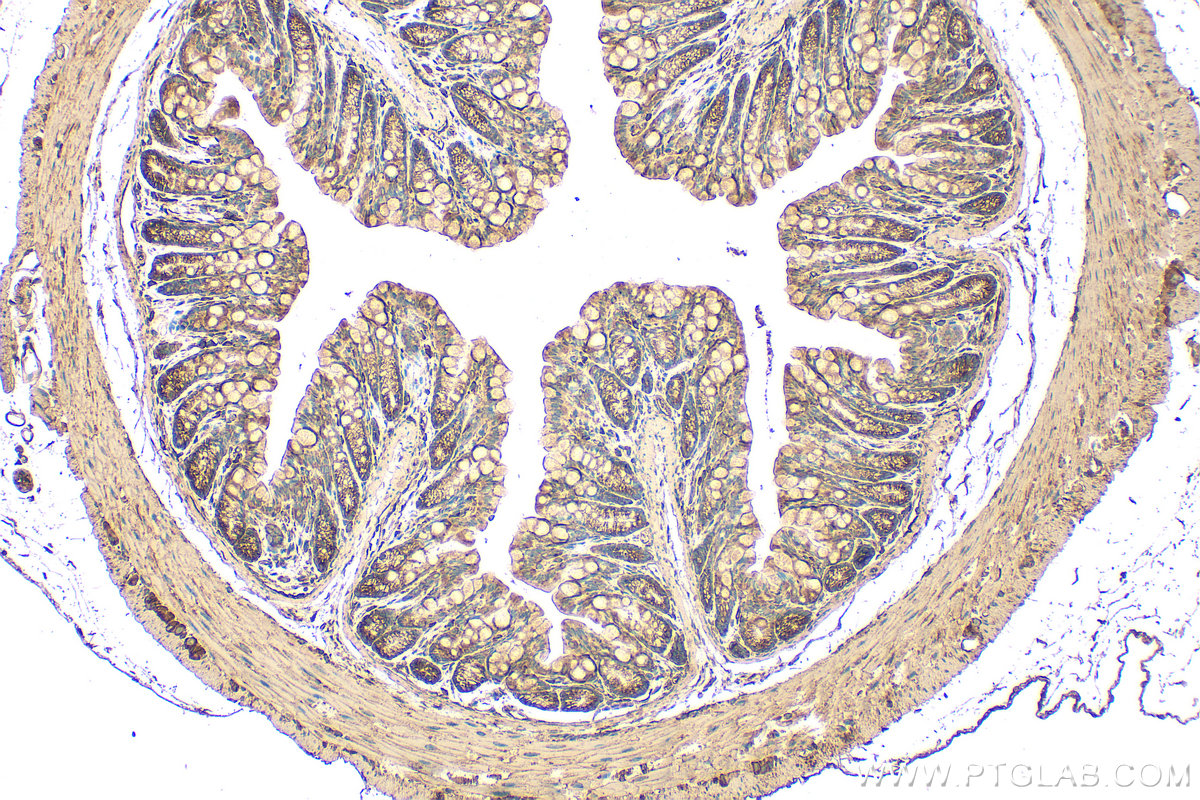 IHC staining of mouse colon using 31499-1-AP IHC staining of mouse colon using 31499-1-AP