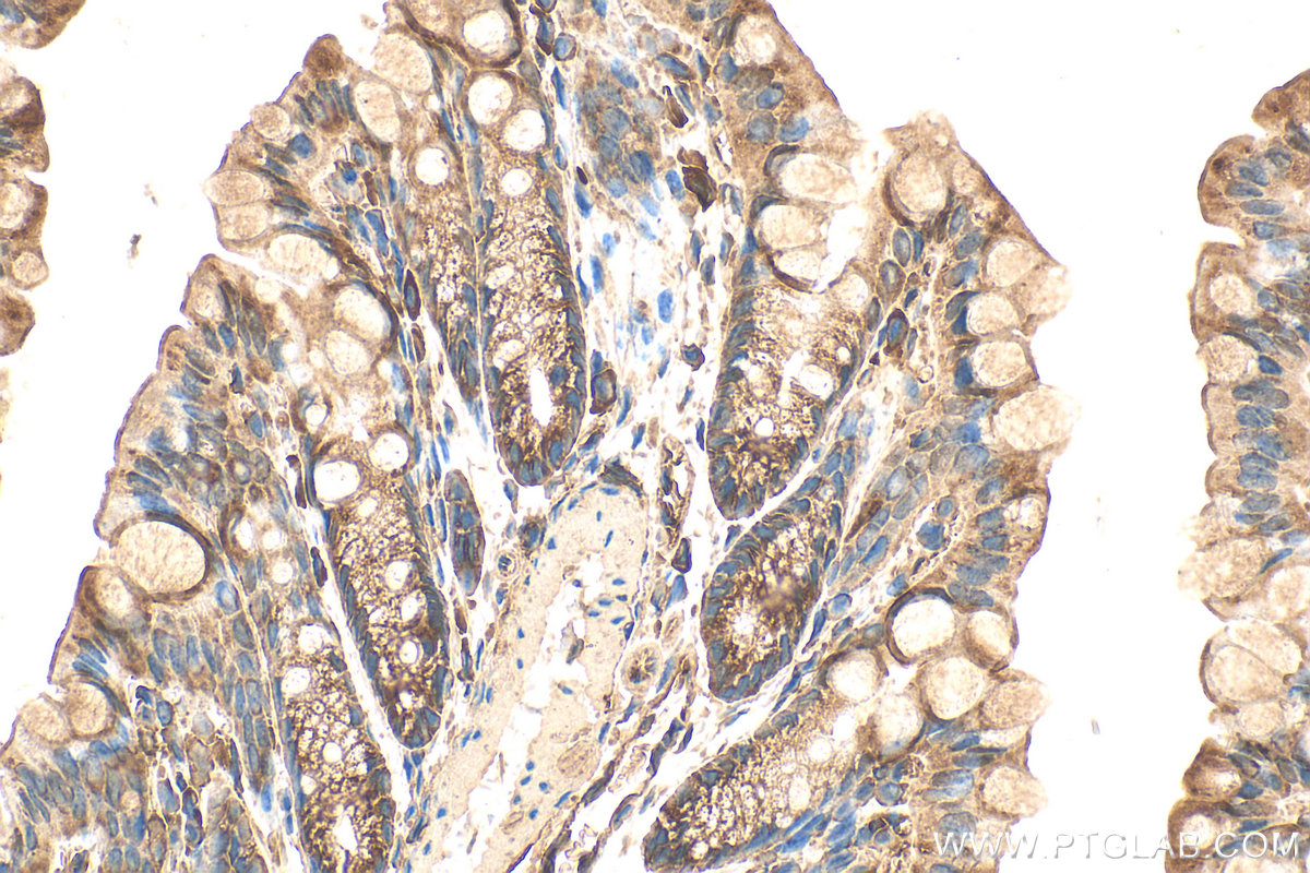 IHC staining of mouse colon using 31499-1-AP IHC staining of mouse colon using 31499-1-AP