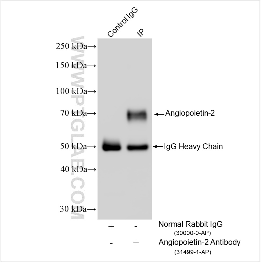 IP experiment of rat lung using 31499-1-AP IP experiment of rat lung using 31499-1-AP