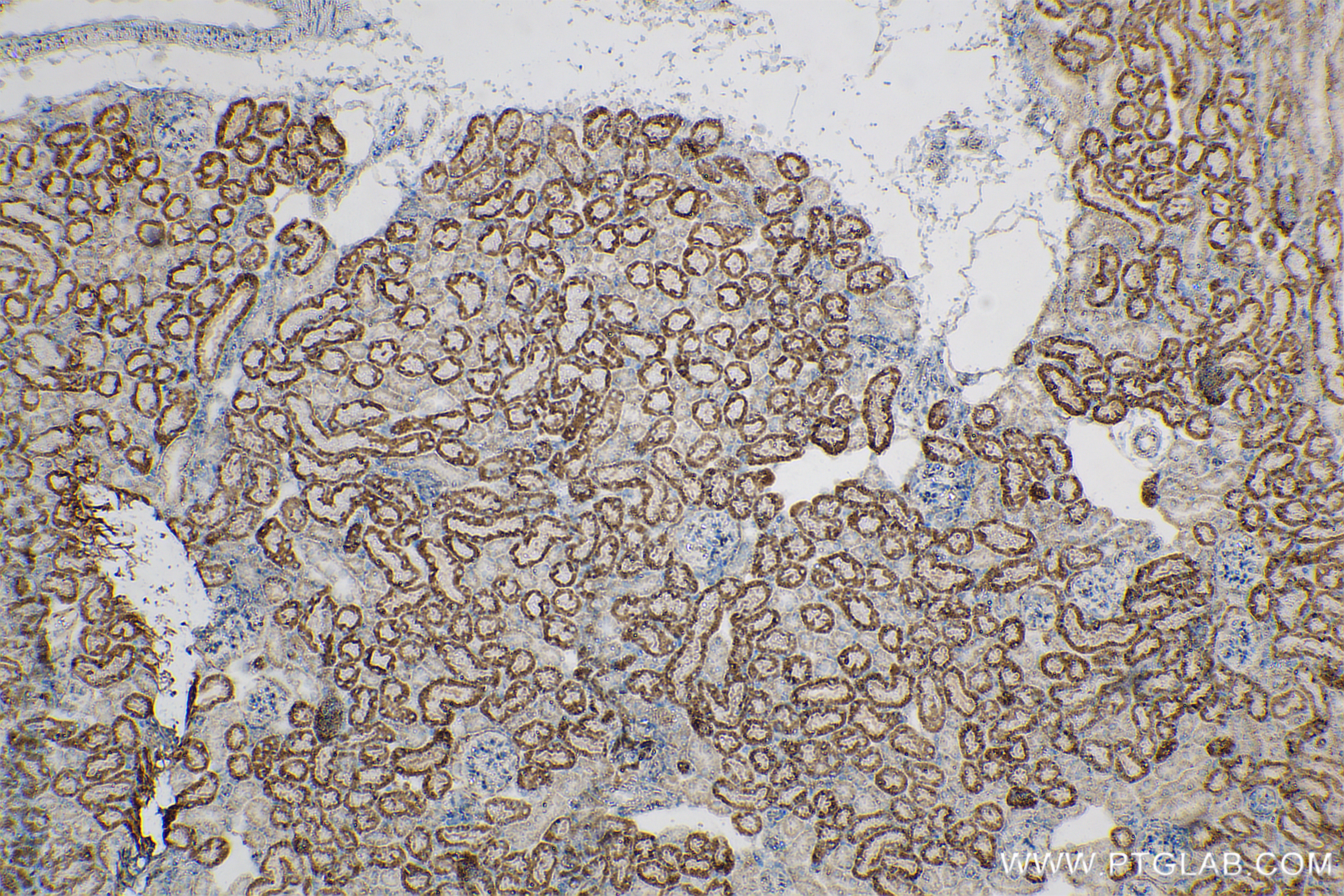 IHC staining of mouse kidney using 83816-1-RR