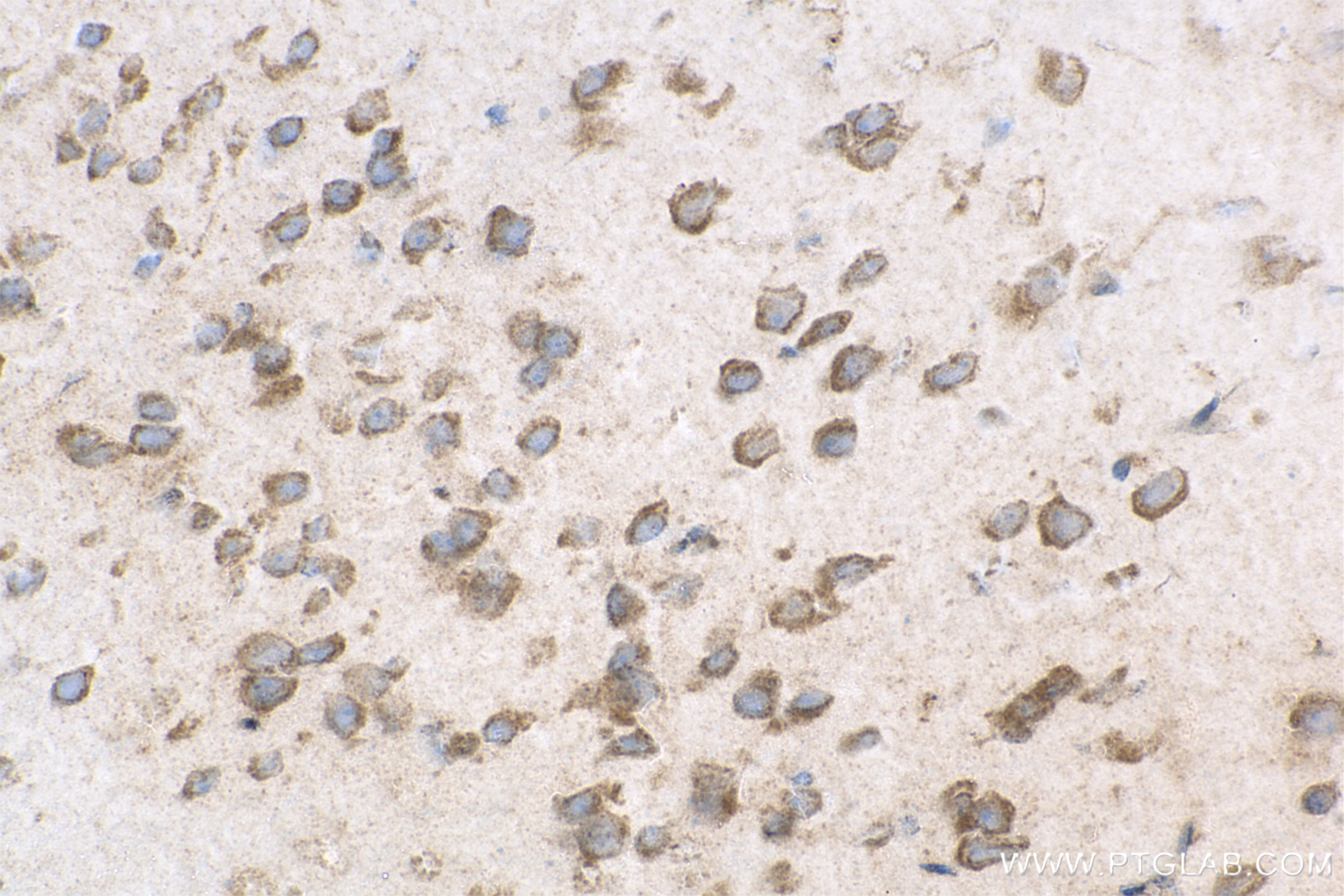 IHC staining of mouse brain using 83816-1-RR