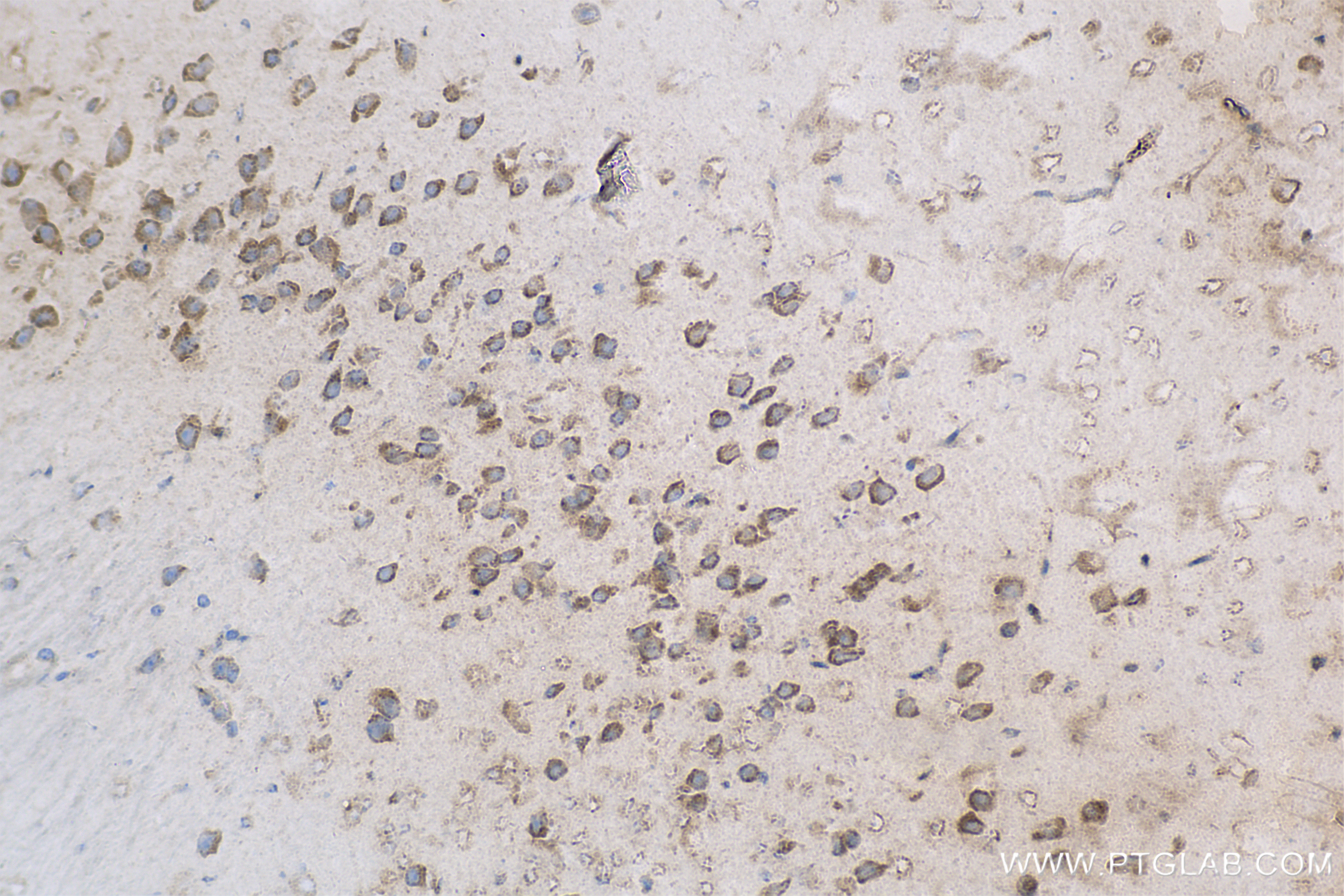 IHC staining of mouse brain using 83816-1-RR