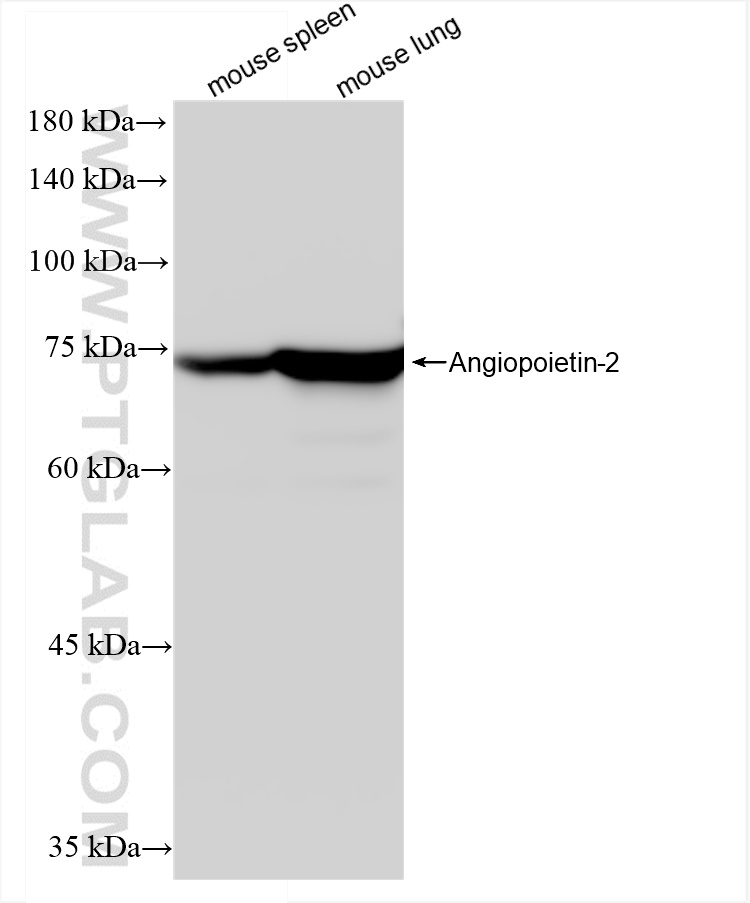 WB analysis using 83816-1-RR