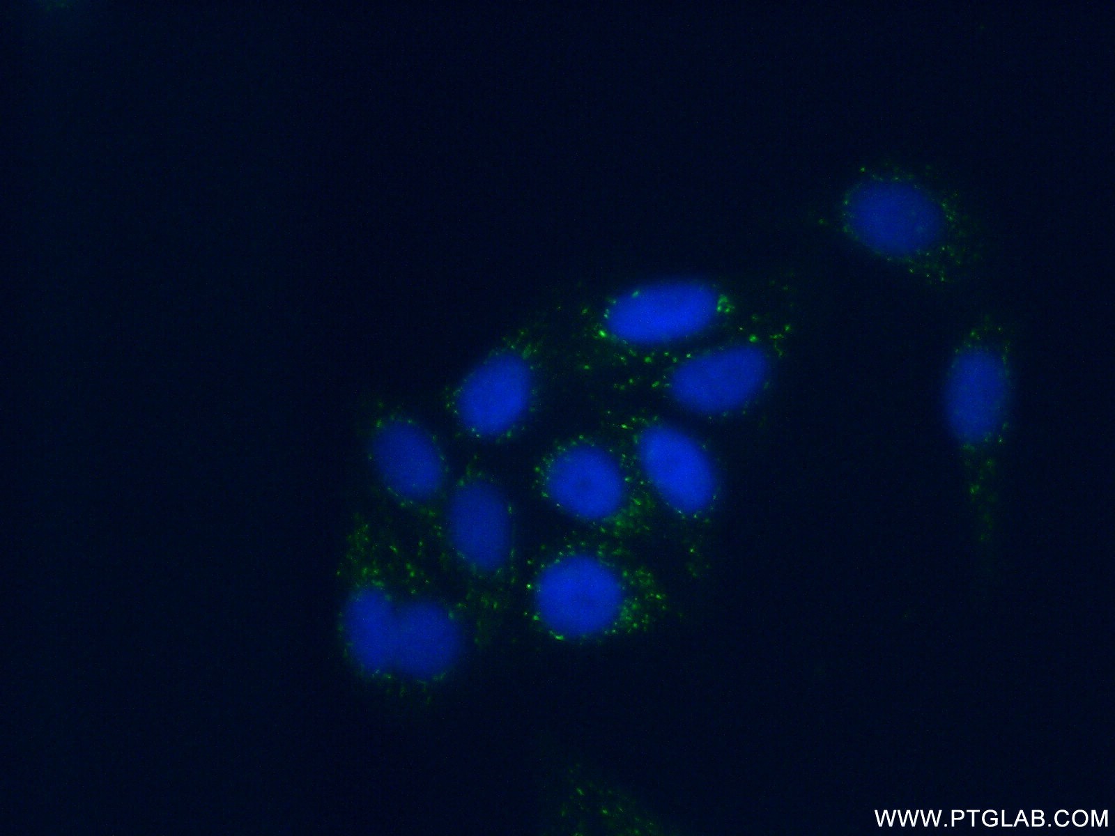 IF Staining of HepG2 using 18300-1-AP