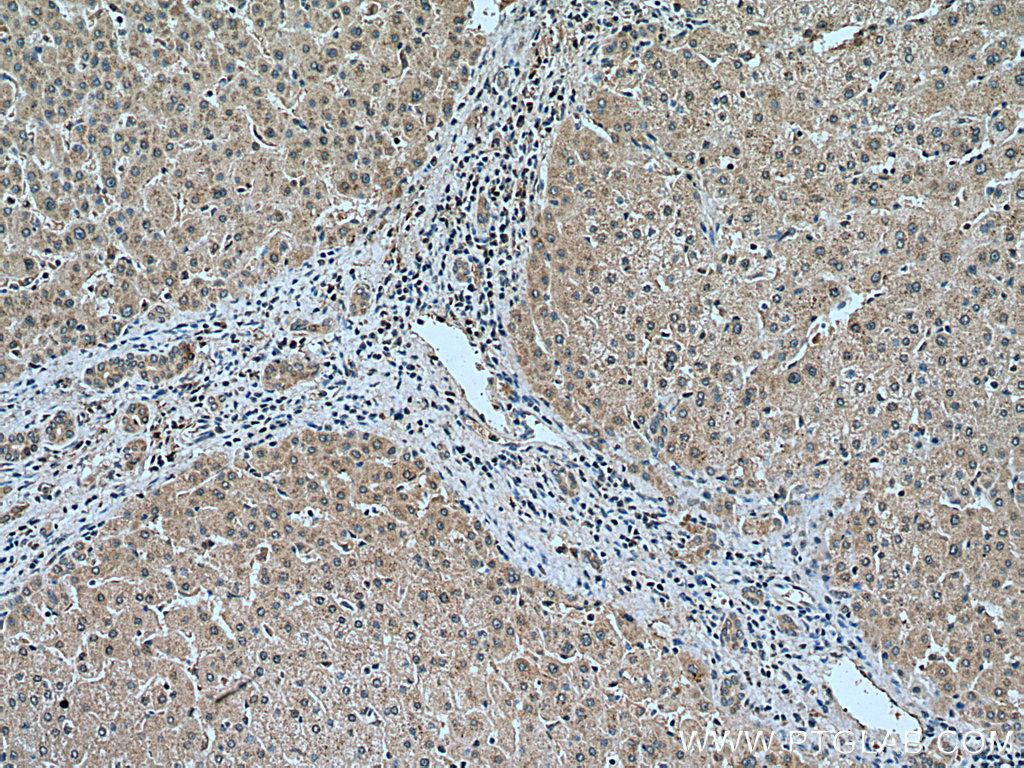 IHC staining of human liver using 18300-1-AP