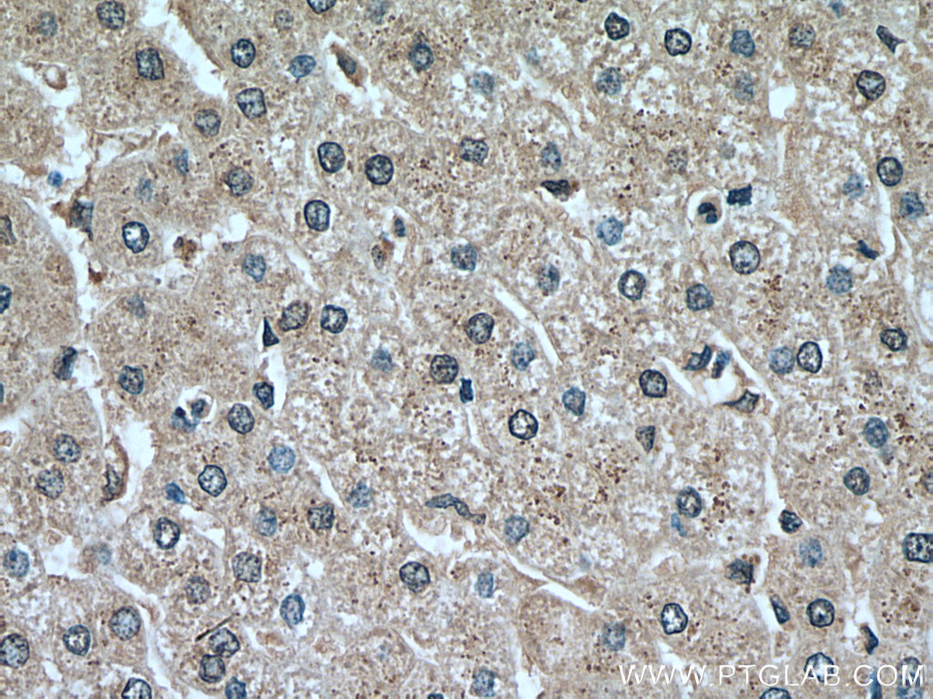 IHC staining of human liver using 18300-1-AP