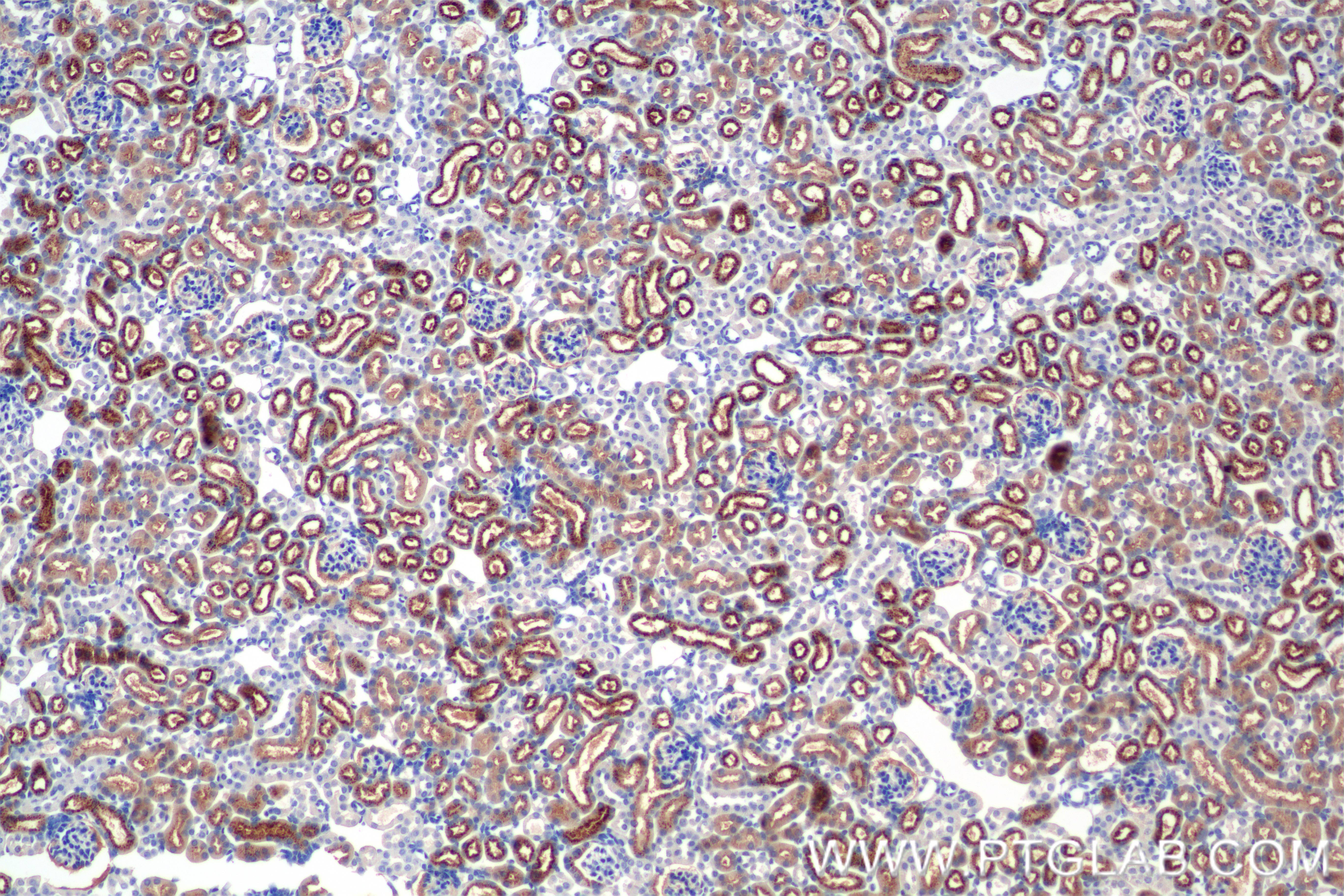 Immunohistochemical analysis of paraffin-embedded mouse kidney tissue slide using 86134-1-RR (Angiotensinogen/AGT antibody) at dilution of 1:500 (under 10x lens). Heat mediated antigen retrieval with Tris-EDTA buffer (pH 9.0). IHC staining of mouse kidney using 86134-1-RR