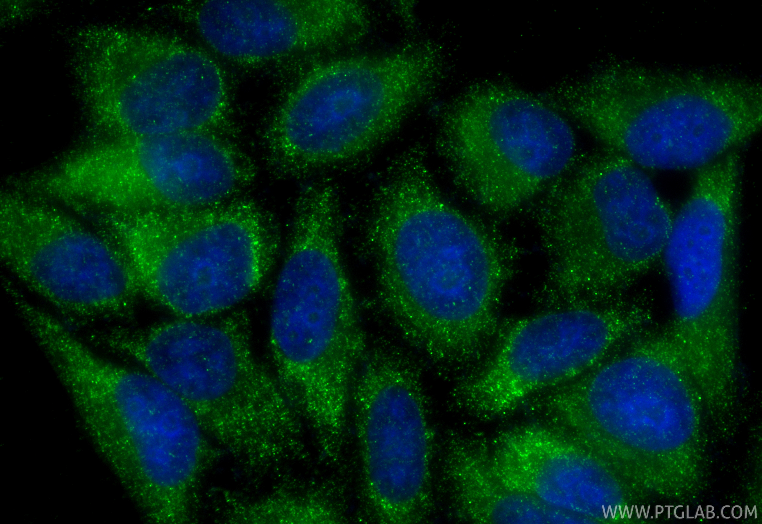 IF Staining of HepG2 using RMX00082