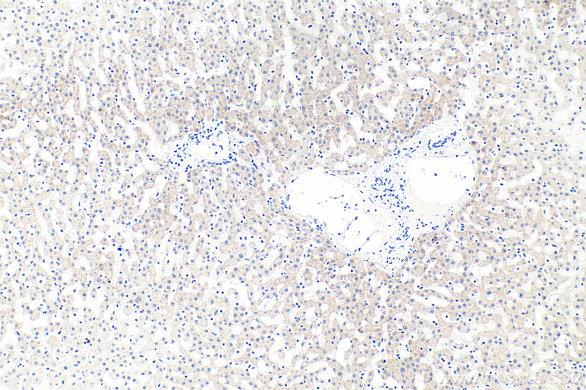IHC staining of human liver using RMX00082