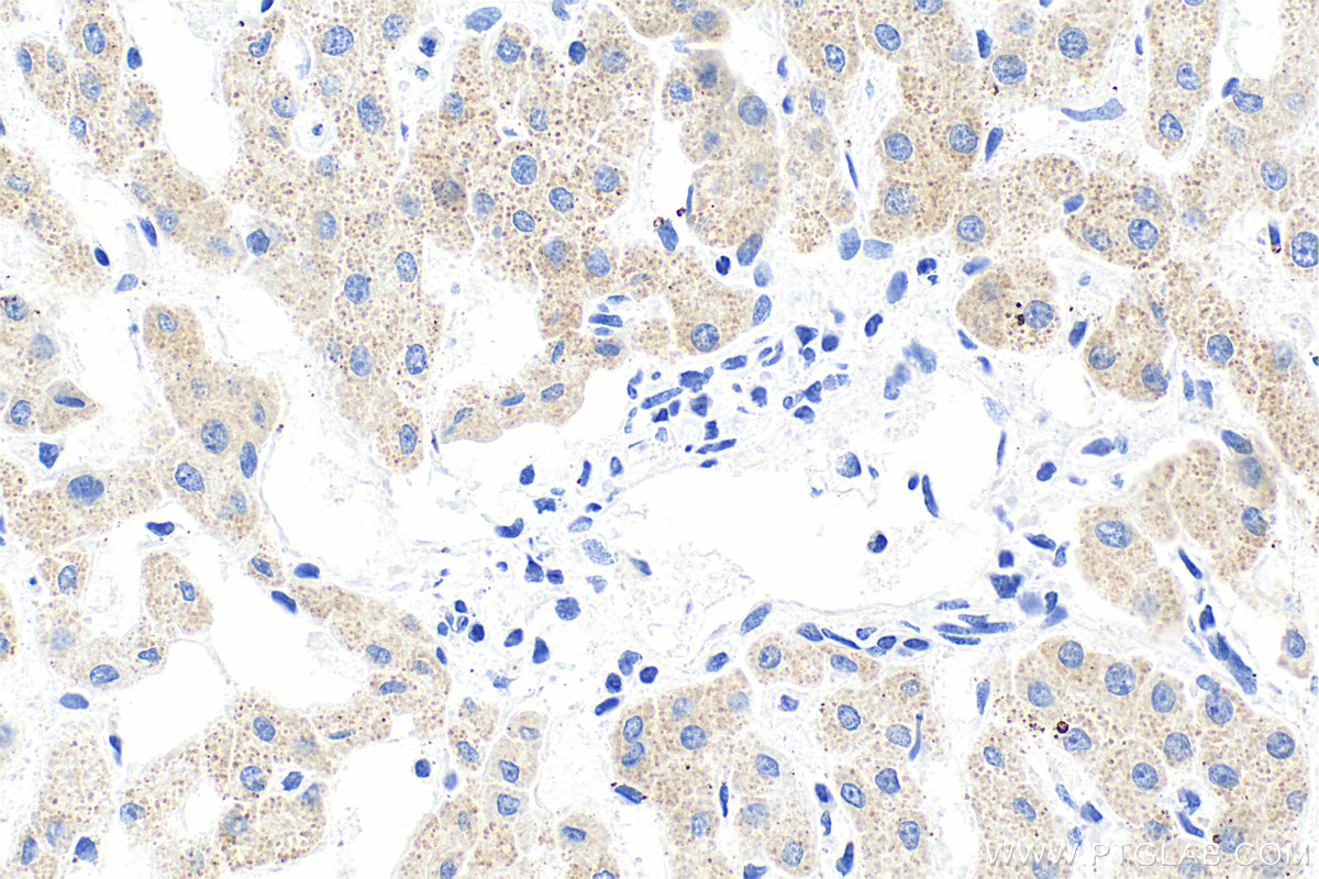 IHC staining of human liver using RMX00082