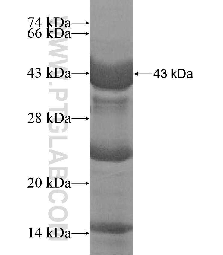 Angptl3 fusion protein Ag17335 SDS-PAGE Angptl3 fusion protein Ag17335 SDS-PAGE