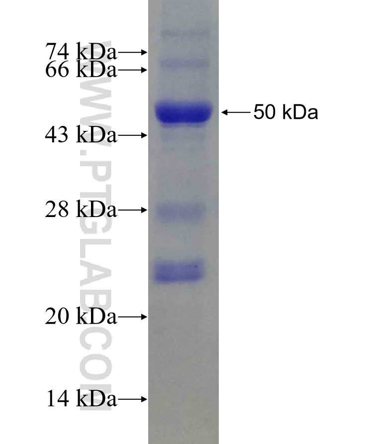 Angptl4 fusion protein Ag21514 SDS-PAGE Angptl4 fusion protein Ag21514 SDS-PAGE