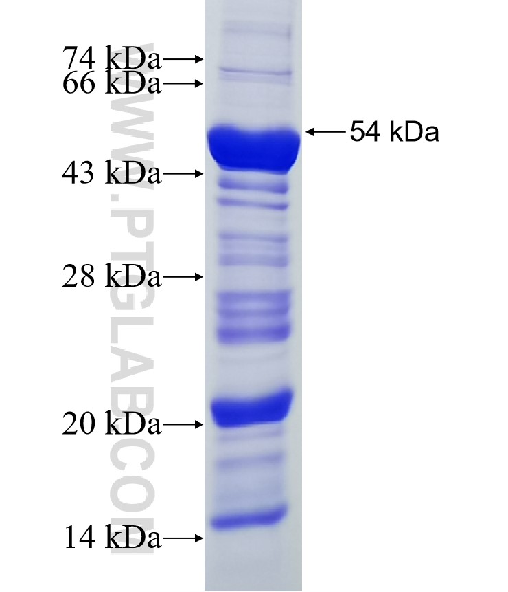 Angptl4 fusion protein Ag0543 SDS-PAGE Angptl4 fusion protein Ag0543 SDS-PAGE