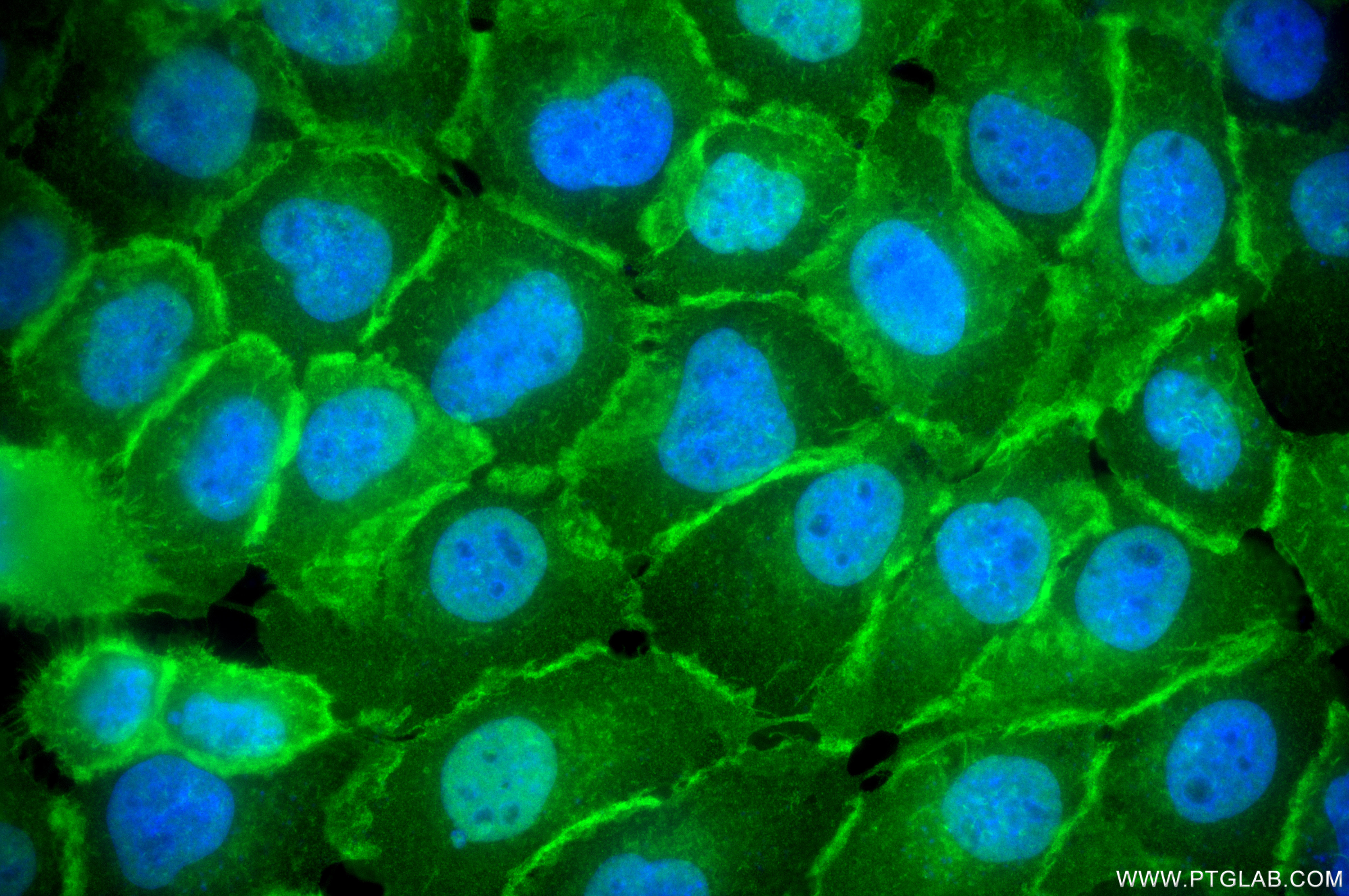 IF Staining of A431 using 87316-3-RR