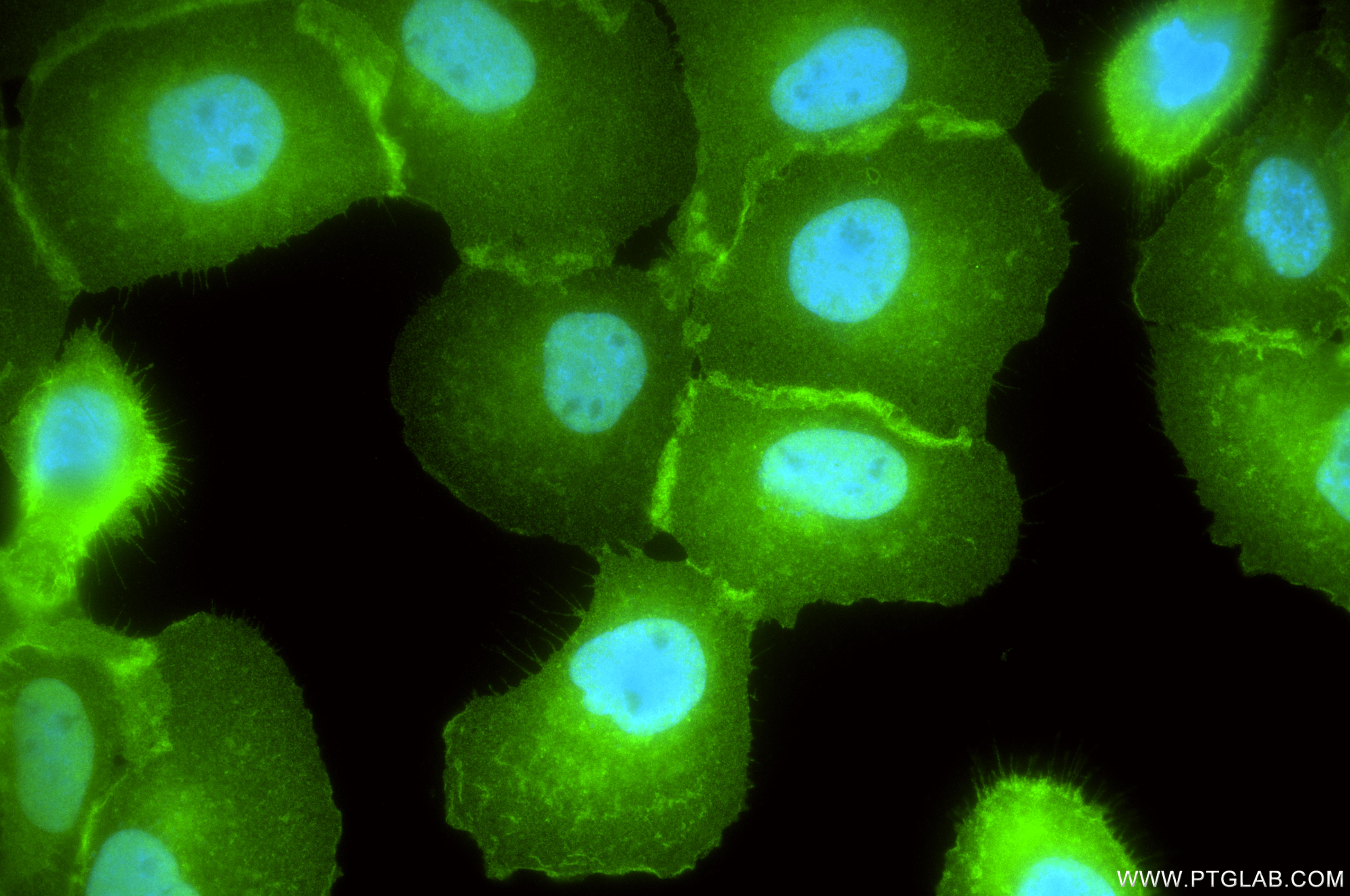 IF Staining of A431 using 87316-3-RR