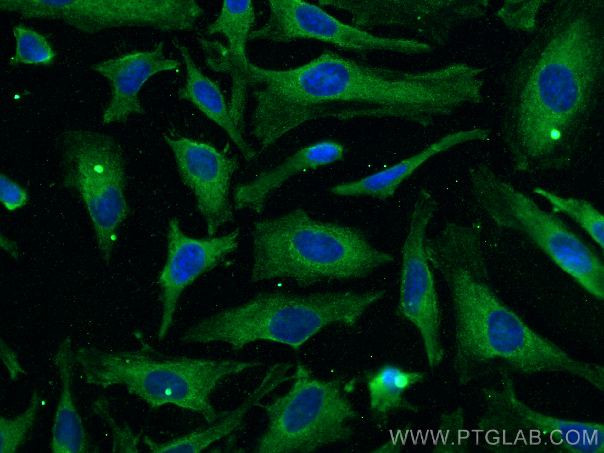 IF Staining of HeLa using 68089-1-Ig