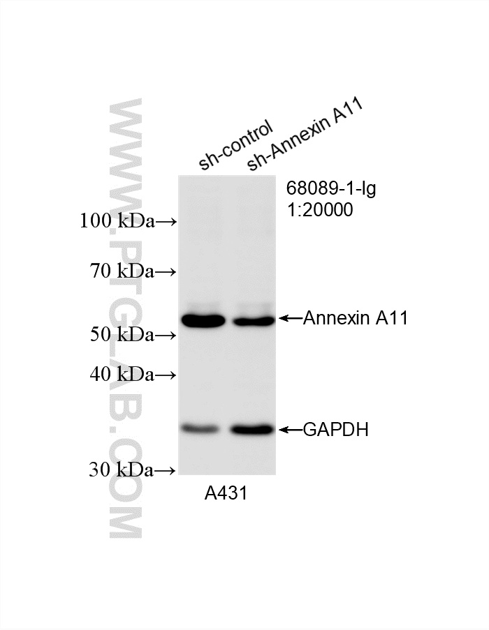 WB result of Annexin A11 antibody (68089-1-Ig; 1:20000; incubated at room temperature for 1.5 hours) with sh-Control and sh-Annexin A11 transfected A431 cells. WB analysis of A431 using 68089-1-Ig