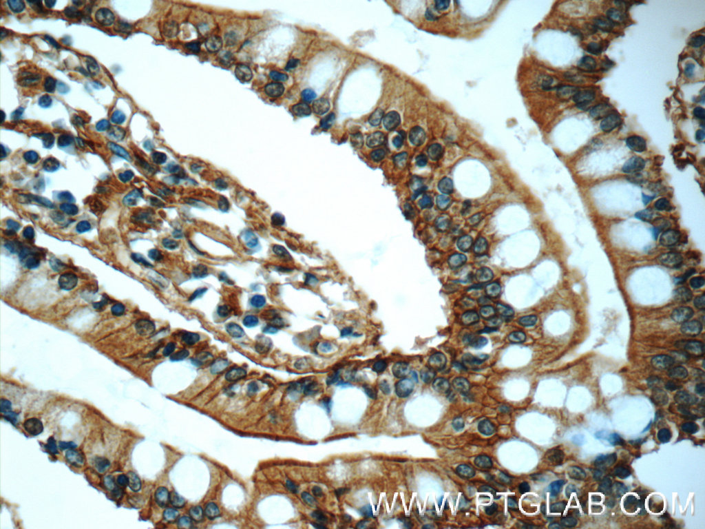 IHC staining of human small intestine using 25153-1-AP