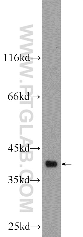 WB analysis of mouse skeletal muscle using 25153-1-AP