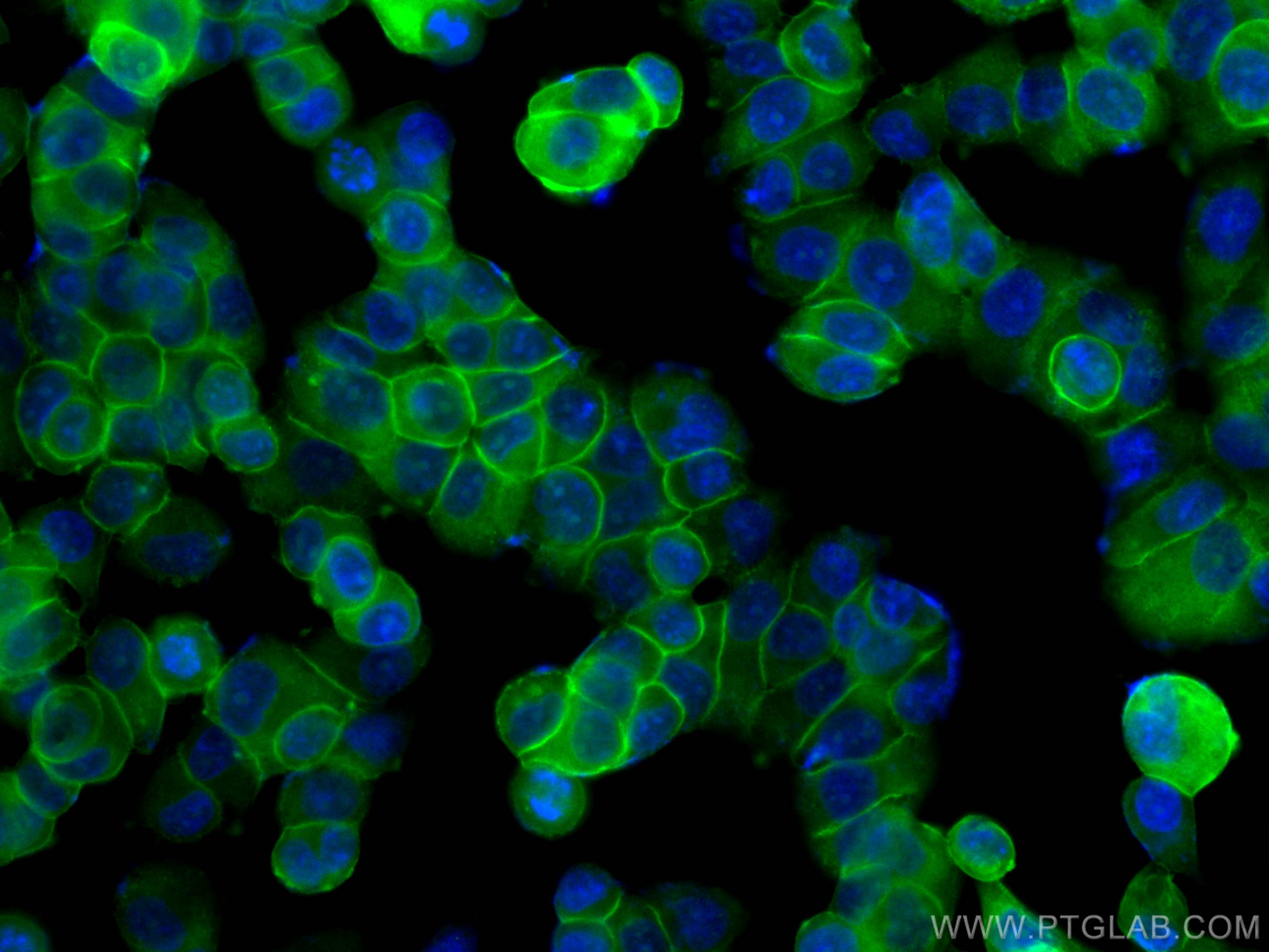 IF Staining of T-47D using CL488-66035