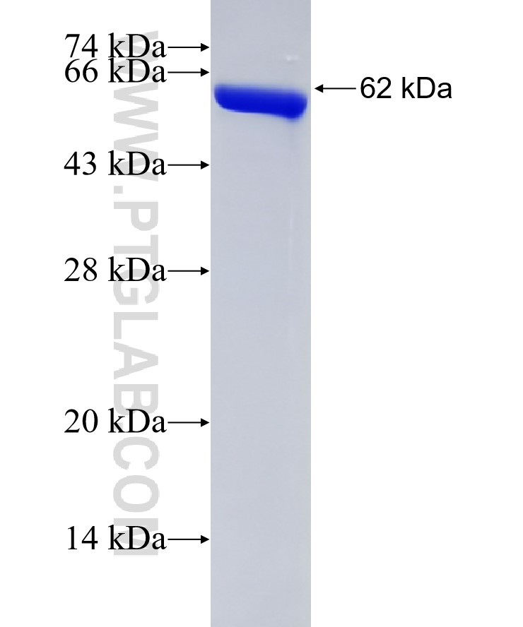 Annexin A2 fusion protein Ag1777 SDS-PAGE